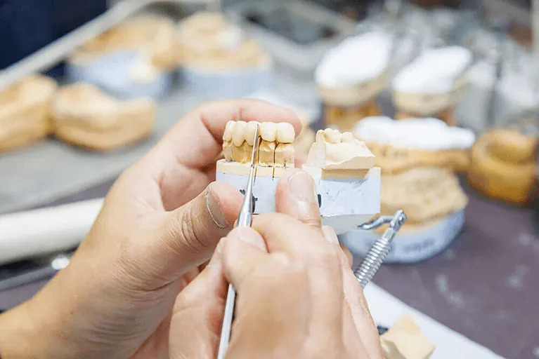 3.歯科技工士が常駐し、短時間で精巧な補綴物ができる