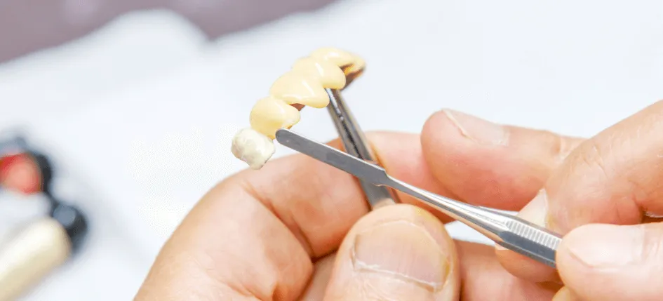 歯科技工士が常駐し短時間で精巧な補綴物ができる